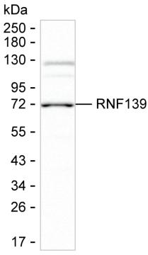 RNF139